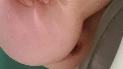 Teaser poop