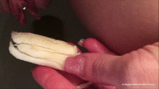 Yucky Yeast Infection Diary